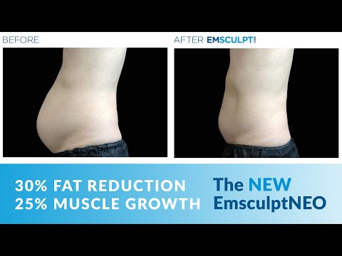 EmsculptNEO is now available at JUVA Skin & Laser Center in NYC!